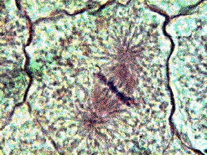 Chromosome pendant la mitose