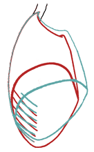 diaphragme